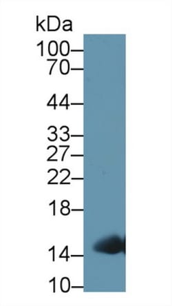 Invitrogen Hemoglobin Polyclonal Antibody, Invitrogen 200 &mu;L; Unconjugated:Antibodies,