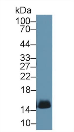 Invitrogen Hemoglobin Polyclonal Antibody, Invitrogen 200 &mu;L; Unconjugated:Antibodies,