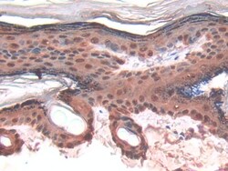 Galectin 7 Polyclonal Antibody, Invitrogen:Antibodies:Primary Antibodies