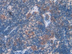 Galectin 7 Polyclonal Antibody, Invitrogen:Antibodies:Primary Antibodies