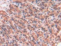 Galectin 7 Polyclonal Antibody, Invitrogen:Antibodies:Primary Antibodies