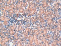 Galectin 7 Polyclonal Antibody, Invitrogen:Antibodies:Primary Antibodies