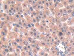 Galectin 7 Polyclonal Antibody, Invitrogen:Antibodies:Primary Antibodies