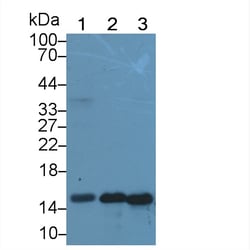 Galectin 7 Polyclonal Antibody, Invitrogen:Antibodies:Primary Antibodies