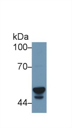 Invitrogen CYP3A7 Polyclonal Antibody, Invitrogen:Antibodies:Primary Antibodies