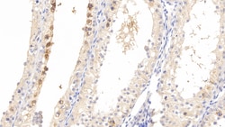 Pleiotrophin Polyclonal Antibody, Invitrogen:Antibodies:Primary Antibodies