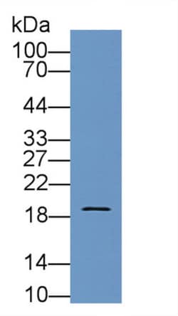 Pleiotrophin Polyclonal Antibody, Invitrogen:Antibodies:Primary Antibodies