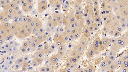 Invitrogen IL13RA2 Polyclonal Antibody, Invitrogen 20 &mu;L; Unconjugated:Antibodies,