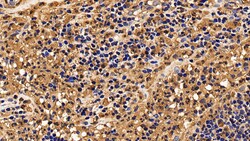 Invitrogen IL13RA2 Polyclonal Antibody, Invitrogen 20 &mu;L; Unconjugated:Antibodies,