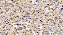 Invitrogen IL13RA2 Polyclonal Antibody, Invitrogen 20 &mu;L; Unconjugated:Antibodies,