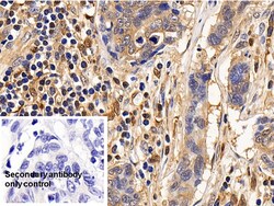 Invitrogen IL13RA2 Polyclonal Antibody, Invitrogen 20 &mu;L; Unconjugated:Antibodies,