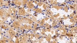 Invitrogen IL13RA2 Polyclonal Antibody, Invitrogen 20 &mu;L; Unconjugated:Antibodies,