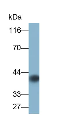 Invitrogen IL13RA2 Polyclonal Antibody, Invitrogen 20 &mu;L; Unconjugated:Antibodies,