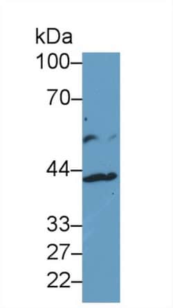 Invitrogen IL13RA2 Polyclonal Antibody, Invitrogen 20 &mu;L; Unconjugated:Antibodies,