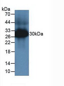 Tryptase Polyclonal Antibody, Invitrogen:Antibodies:Primary Antibodies