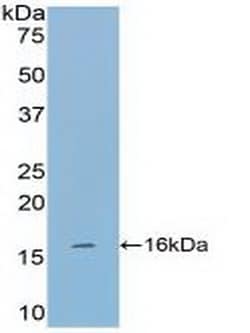 Tryptase Polyclonal Antibody, Invitrogen:Antibodies:Primary Antibodies