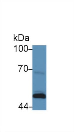 Invitrogen SERPINB4 Polyclonal Antibody, Invitrogen 20 &mu;L; Unconjugated:Antibodies,