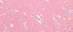 Invitrogen BACE2 Polyclonal Antibody, Invitrogen 20 &mu;L; Unconjugated:Antibodies,