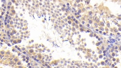 Invitrogen BACE2 Polyclonal Antibody, Invitrogen 20 &mu;L; Unconjugated:Antibodies,