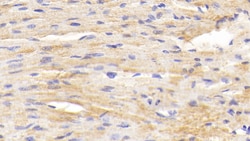 Invitrogen BACE2 Polyclonal Antibody, Invitrogen 20 &mu;L; Unconjugated:Antibodies,