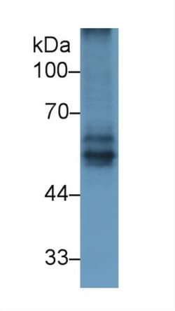 Invitrogen BACE2 Polyclonal Antibody, Invitrogen 20 &mu;L; Unconjugated:Antibodies,