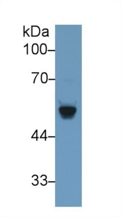 Invitrogen BACE2 Polyclonal Antibody, Invitrogen 20 &mu;L; Unconjugated:Antibodies,