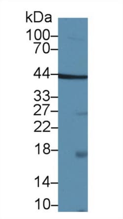 TAZ Polyclonal Antibody, Invitrogen:Antibodies:Primary Antibodies