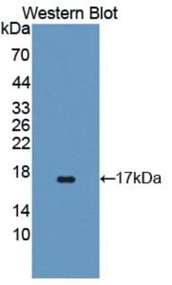 TAZ Polyclonal Antibody, Invitrogen:Antibodies:Primary Antibodies