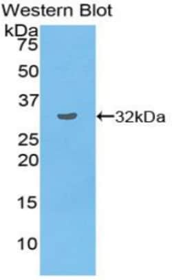 Invitrogen TOR3A Polyclonal Antibody, Invitrogen 20 &mu;L; Unconjugated:Antibodies,