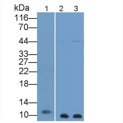 Invitrogen S100B Polyclonal Antibody, Invitrogen 200 &mu;L; Unconjugated:Antibodies,