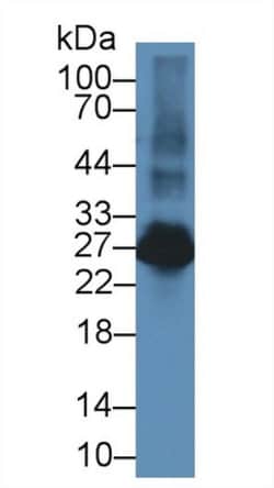 Invitrogen NTAL Polyclonal Antibody, Invitrogen 20 &mu;L; Unconjugated:Antibodies,