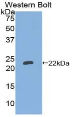 Invitrogen NTAL Polyclonal Antibody, Invitrogen 20 &mu;L; Unconjugated:Antibodies,