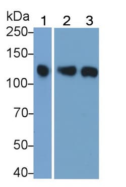 Invitrogen JAK3 Polyclonal Antibody, Invitrogen:Antibodies:Primary Antibodies