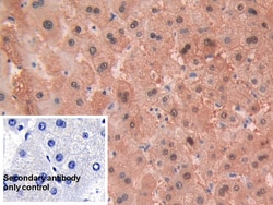 Invitrogen Alcohol Dehydrogenase 1A Polyclonal Antibody, Invitrogen 200