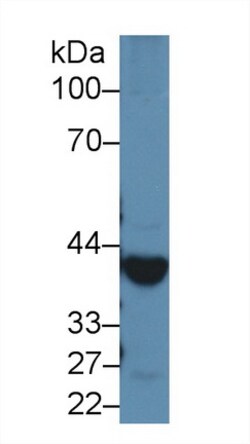 Invitrogen Alcohol Dehydrogenase 1A Polyclonal Antibody, Invitrogen 200