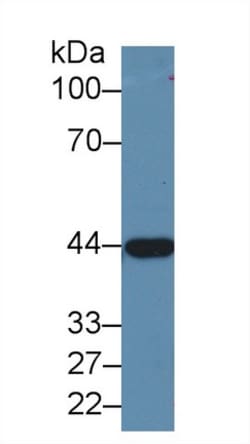 Invitrogen Alcohol Dehydrogenase 1A Polyclonal Antibody, Invitrogen 200
