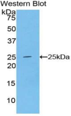 Invitrogen Alcohol Dehydrogenase 1A Polyclonal Antibody, Invitrogen 200