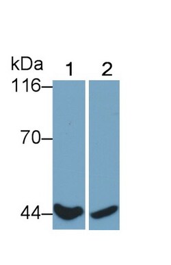CD64 Polyclonal Antibody, Invitrogen:Antibodies:Primary Antibodies