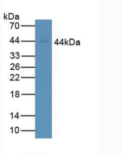 CD64 Polyclonal Antibody, Invitrogen:Antibodies:Primary Antibodies