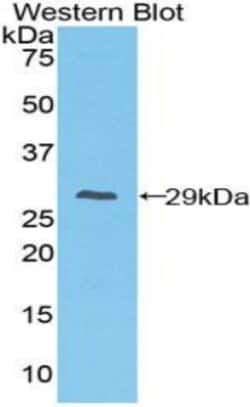 CD64 Polyclonal Antibody, Invitrogen:Antibodies:Primary Antibodies