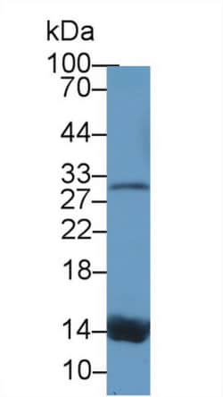 Invitrogen Transthyretin Polyclonal Antibody, Invitrogen 200 &mu;L; Unconjugated:Antibodies,