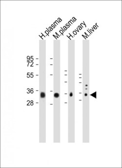 Invitrogen APOE Polyclonal Antibody 400 &mu;L; Unconjugated:Antibodies,