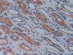 Invitrogen COX1 Polyclonal Antibody, Invitrogen 20 &mu;L; Unconjugated:Antibodies,