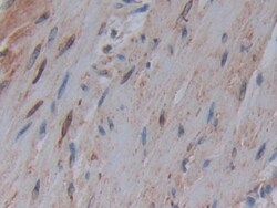 Invitrogen COX1 Polyclonal Antibody, Invitrogen 20 &mu;L; Unconjugated:Antibodies,