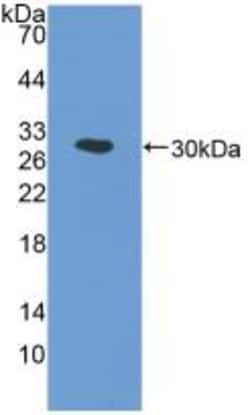Invitrogen COX1 Polyclonal Antibody, Invitrogen 20 &mu;L; Unconjugated:Antibodies,