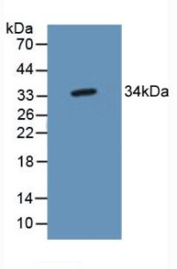 Invitrogen C20orf10 Polyclonal Antibody, Invitrogen 200 &mu;L | Buy Online | Invitrogen&trade; | Fisher Scientific