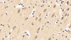 Invitrogen Neuritin Polyclonal Antibody, Invitrogen:Antibodies:Primary