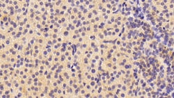 Invitrogen Neuritin Polyclonal Antibody, Invitrogen:Antibodies:Primary