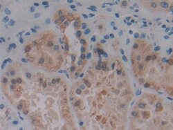 Invitrogen PKC mu Polyclonal Antibody, Invitrogen 20 &mu;L; Unconjugated:Antibodies,