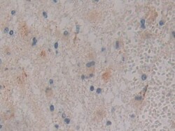 Invitrogen PKC mu Polyclonal Antibody, Invitrogen 20 &mu;L; Unconjugated:Antibodies,